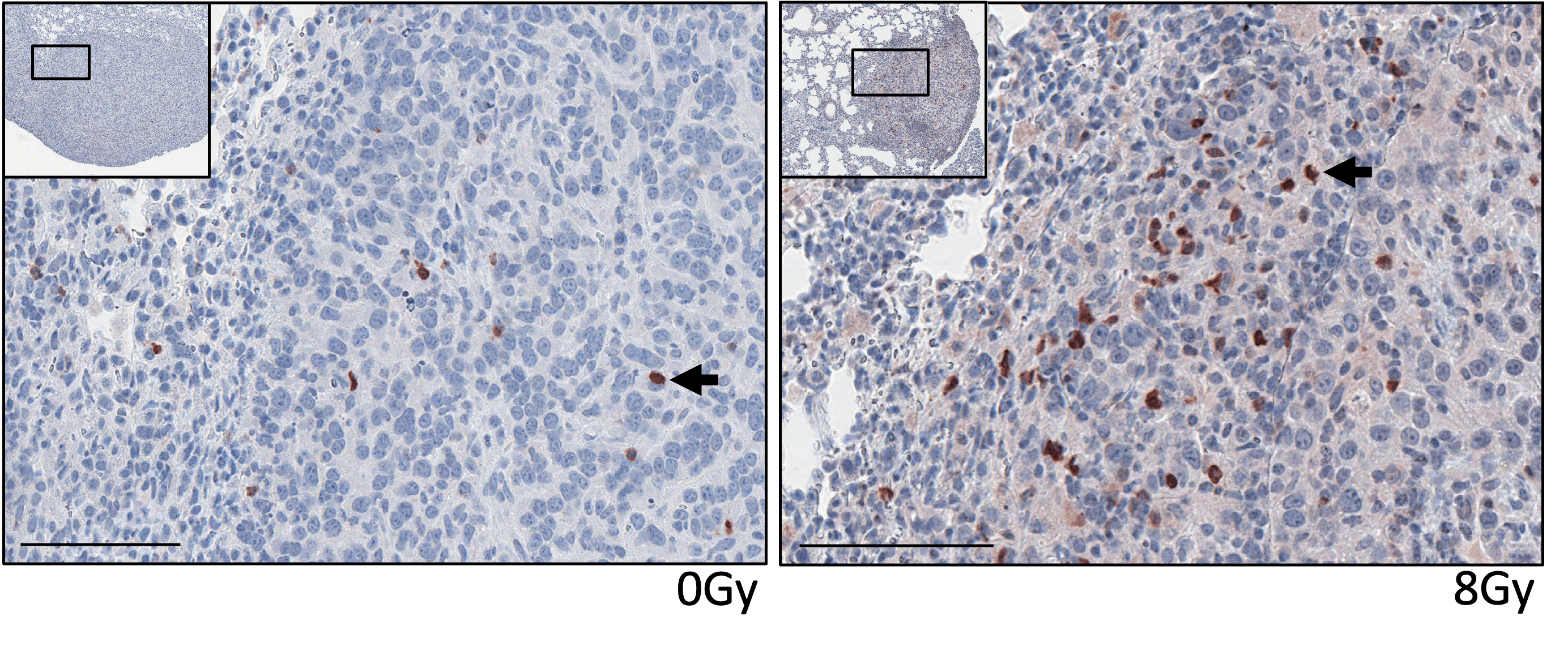 CAR T cells (brown, arrowheads) infiltrating tumors: unirradiated (0 Gy, left) versus irradiated (8 Gy, right)